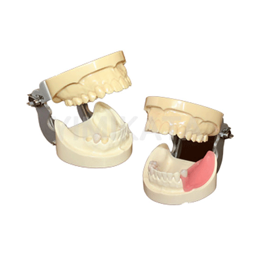 Modelo de enseñanza, Consumibles dentales, material dental, clinica dental, dent